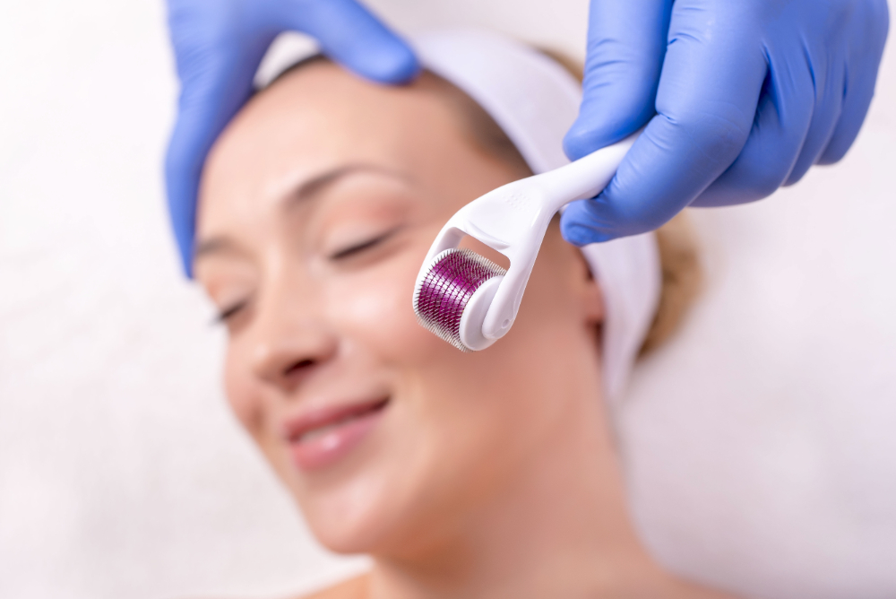derma roller